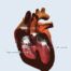 Heartpedia : une application 3D interactive pour étudier les cardiopathies congénitales